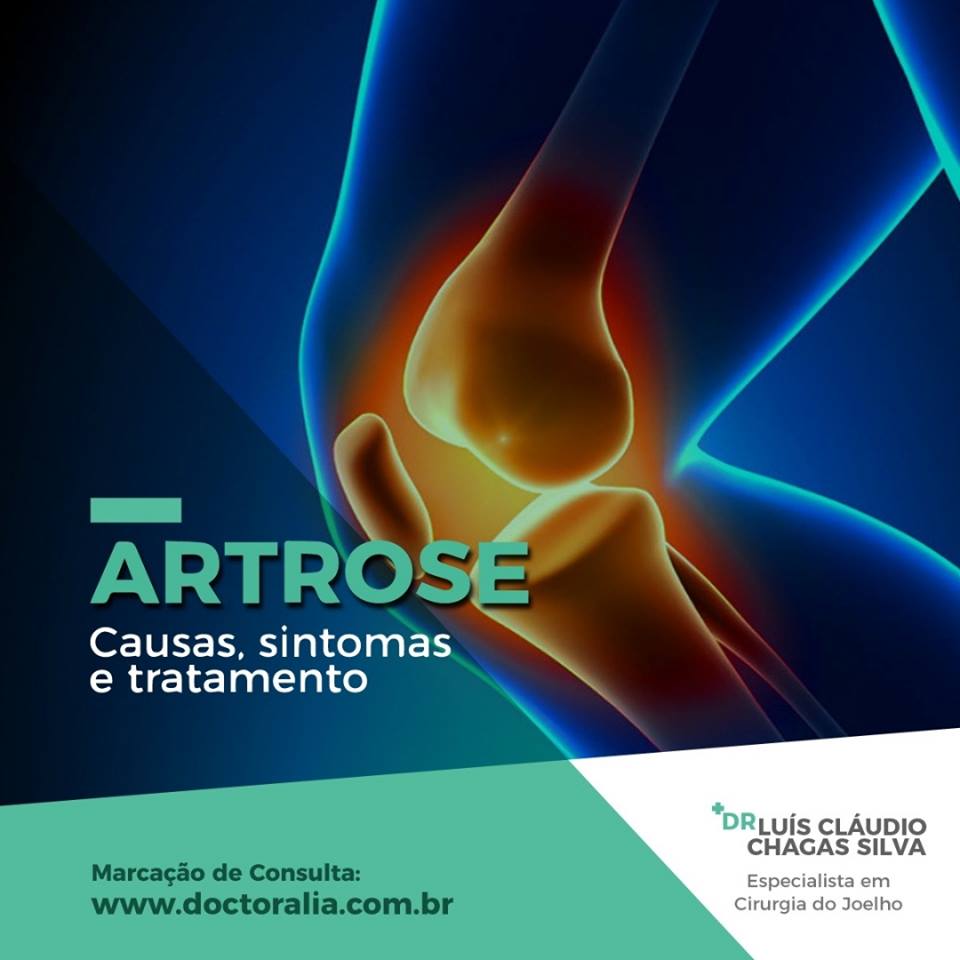 Artrose-Causas sintomas e tratamento