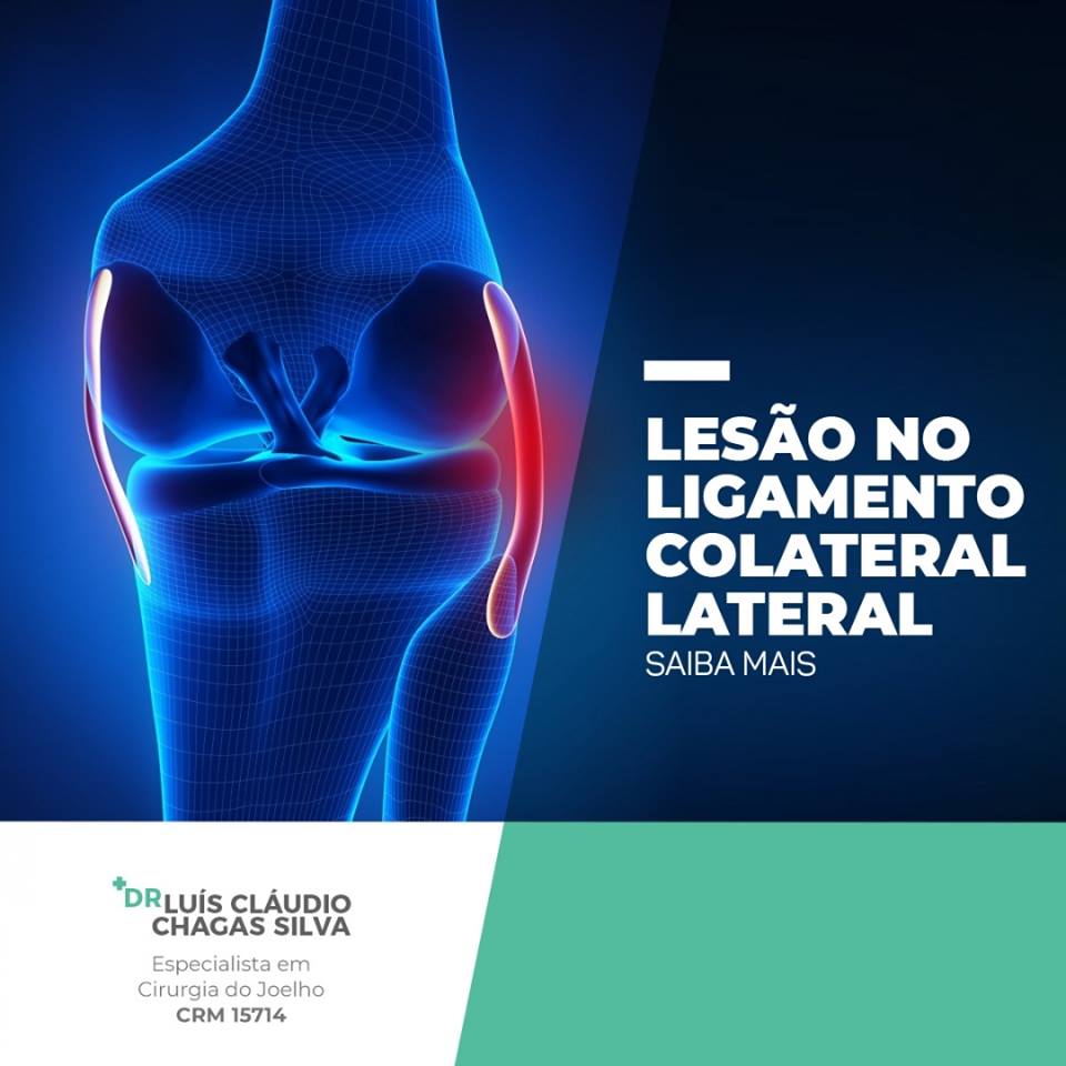 ligamento colateral lateral