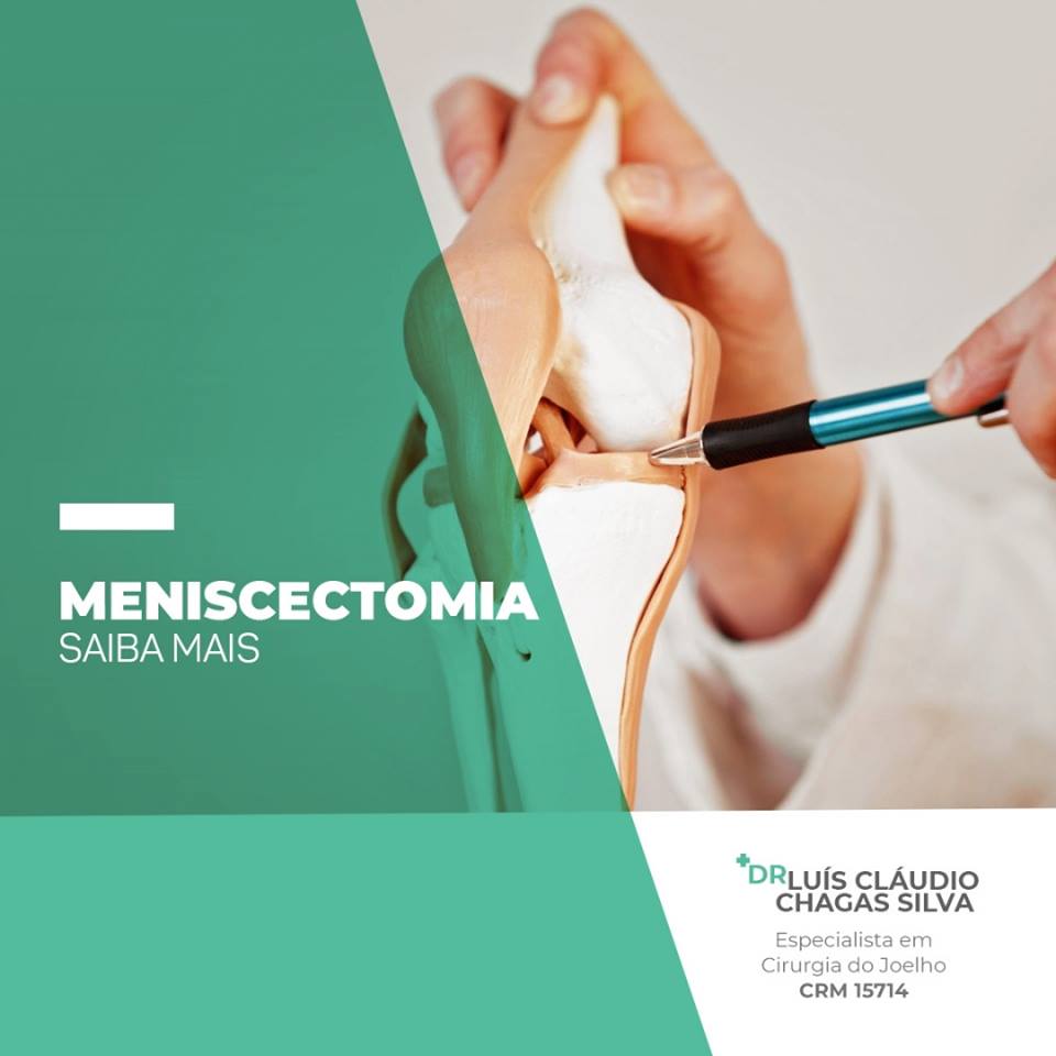 Meniscectomia - Saiba Mais